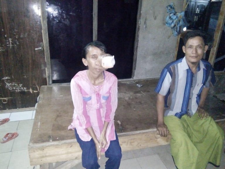 Sopiah Penderita Tumor Ganas Di Bekasi Berharap Bantuan Dermawan